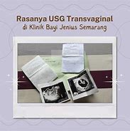 Image result for USG Trans Vaginal Kehamilan 10 Minggu