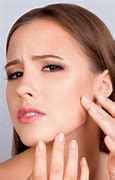 Image result for How to Get Rid Acne Bumps