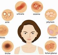 Image result for 10 Common Skin Rashes On Legs