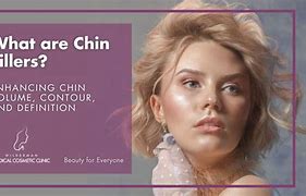 Image result for Chin Correction Filler