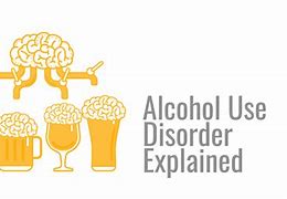 Image result for Alcohol Use Disorder