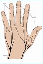 Image result for Dorsal Aspect Hand