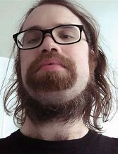 Image result for Cheek Beard