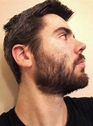 Image result for High Cheek Beard