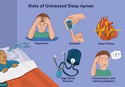 Image result for Sleep Apnea Treatment