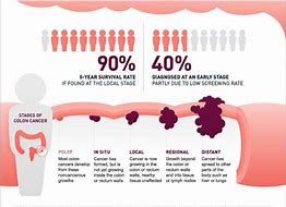 Image result for Colon Cancer Early Symptoms