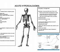 Image result for Acute Hypercalcaemia Bisphosphonate