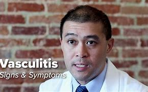 Image result for Vasculitis Signs