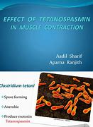 Image result for Tetanospasmin