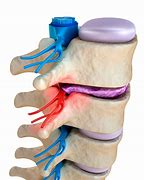 Image result for Pin Nerve Function