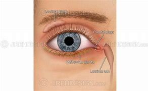 Image result for Lacrimal Papilla