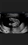 Image result for 5 Month Ultrasound Boy