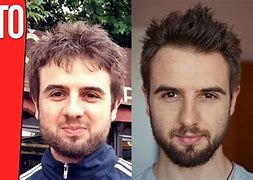 Image result for Lose Face Fat