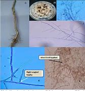 Image result for Rhizoctonia Solani