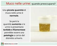 Image result for Muco Urine