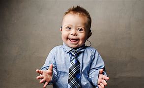 Image result for Down Syndrome Baby Pictures