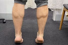 Image result for Tear in Calf Muscle