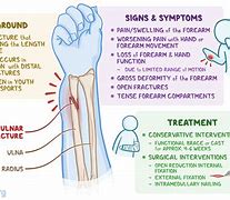 Image result for Radius Fracture