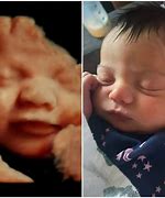 Image result for 5D Scanner Baby