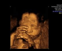 Image result for Baby Scan 3D 4D