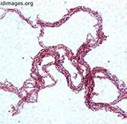 Image result for Mycobacterium GM's Stain