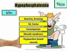 Image result for Acute Hypercalcaemia Bisphosphonate