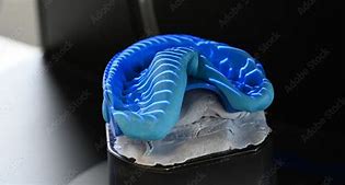 Image result for 3D Teeth Scanner