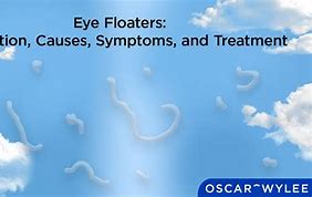 Image result for Different Kinds of Swimming Floaters