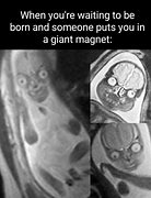 Image result for Lumbar Spine MRI Meme