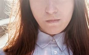 Image result for Female Hair On Chin