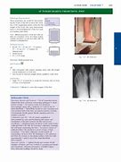 Image result for PA Oblique Lateral Rotation Knee