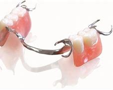 Image result for Partial Plate Dentures