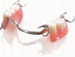 Image result for Upper Partial Dentures Pictures