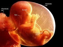 Image result for 16 Weeks Baby in Womb