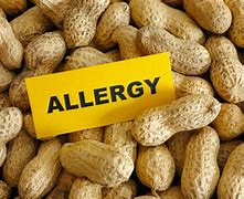 Image result for Peanut Butter Allergy