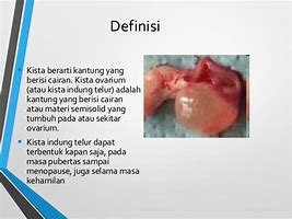 Image result for Kista Adalah