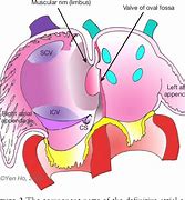 Image result for Interatrial Septum Anatomy