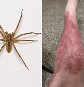 Image result for Spider Rash