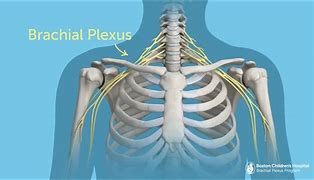 Image result for Brachial Plexus Fall Injury