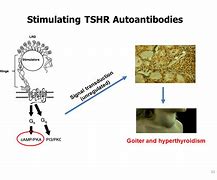 Image result for TSH Receptor Antibodies