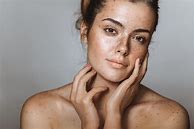 Image result for Interesting Faces Freckles