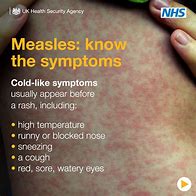 Image result for Bad Measles