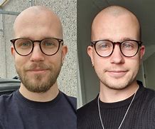 Image result for Growing Out a Beard