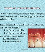 Image result for Attached Gingiva