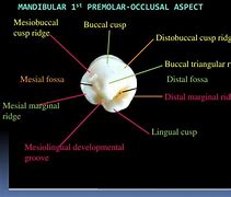 Image result for Mandibular 1st Premolar