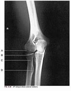 Image result for PA Oblique Lateral Rotation Knee