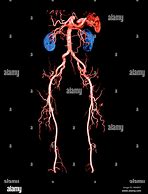 Image result for CT Angiogram Abdomen