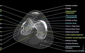 Image result for CT Knee Point Graph