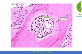 Image result for Osteoblasts in Bone