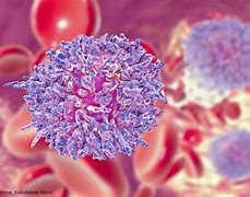 Image result for MRD in CLL